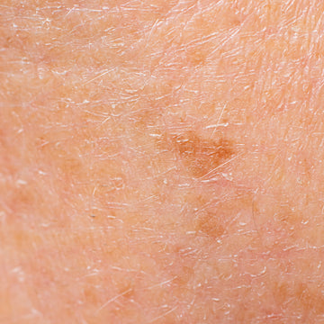 What to Expect When Using This Spot Cream