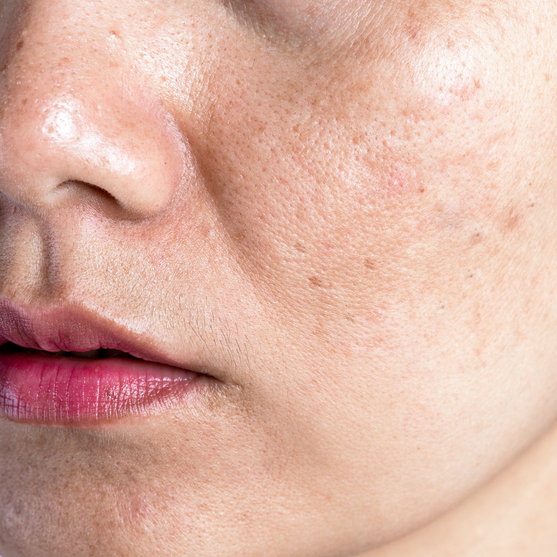 Organic Skin Pigmentation And Dark Spots Corrector - Pure n' Bio