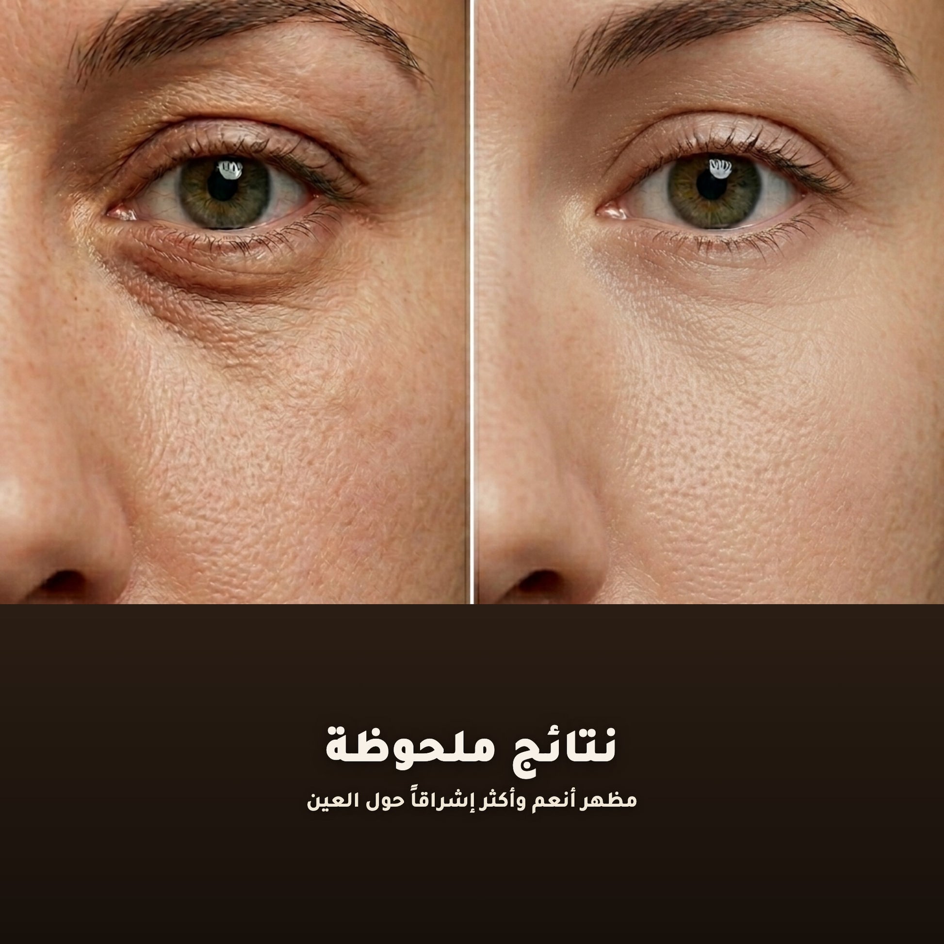 جل العيون العضوي بالورد والأرغان – معتمد عضويًا | بورن تو بيو فيشي – 4