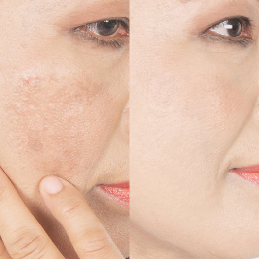 Organic Skin Pigmentation And Dark Spots Corrector